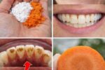 Brighten Your Smile in Minutes: Simple Home Teeth Whitening Tricks That Actually Help