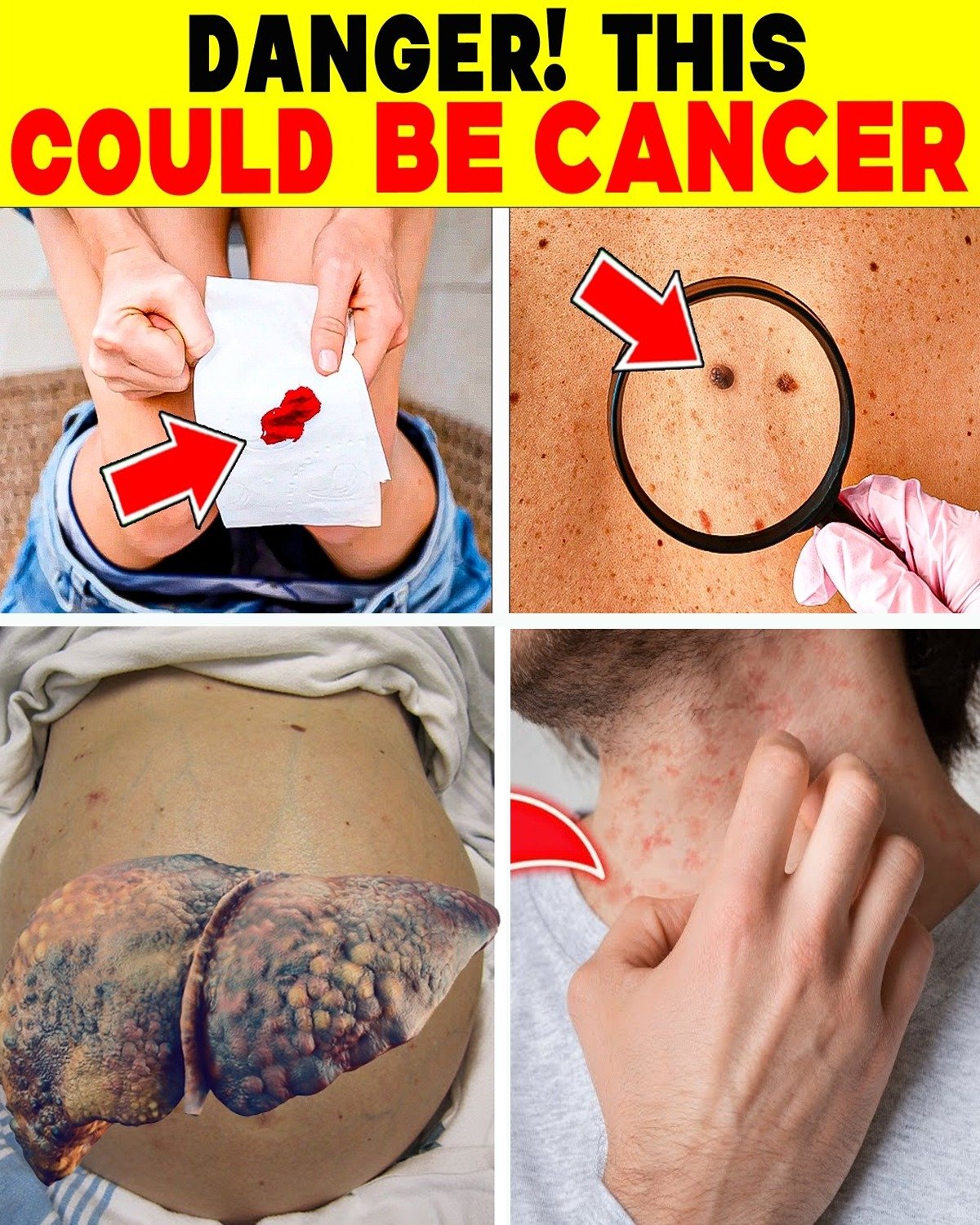 ALERT! 15 Silent Cancers That Few Doctors Talk About – And Why Early Awareness Could Save Your Life