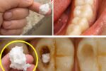 Simple Natural Tips to Keep Your Teeth Healthy – Avoid Extra Dental Visits with These 5 Natural Cavity Remedies