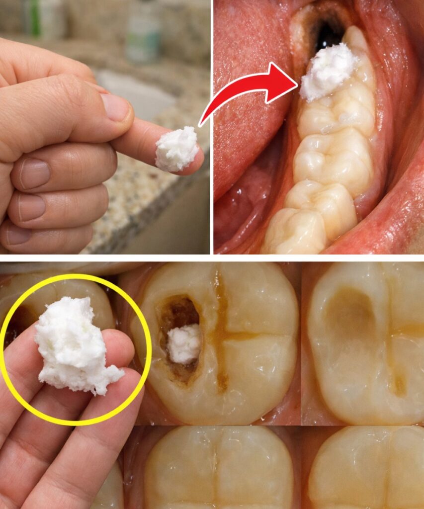Simple Natural Tips to Keep Your Teeth Healthy – Avoid Extra Dental Visits with These 5 Natural Cavity Remedies
