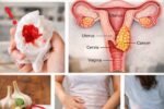 9 Early Warning Signs of Cervical Cancer You Might Be Ignoring