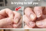 Are Your Nails Always Splitting or Breaking? Here’s What Your Body Might Be Trying to Tell You