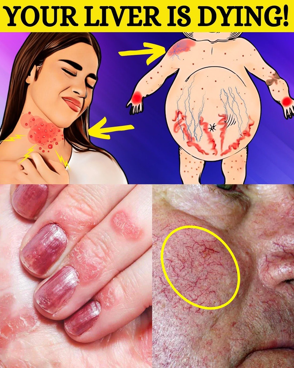 The Silent Threat Hiding in Your Liver: 8 Warning Signs of Fatty Liver Disease You Can’t Afford to Ignore