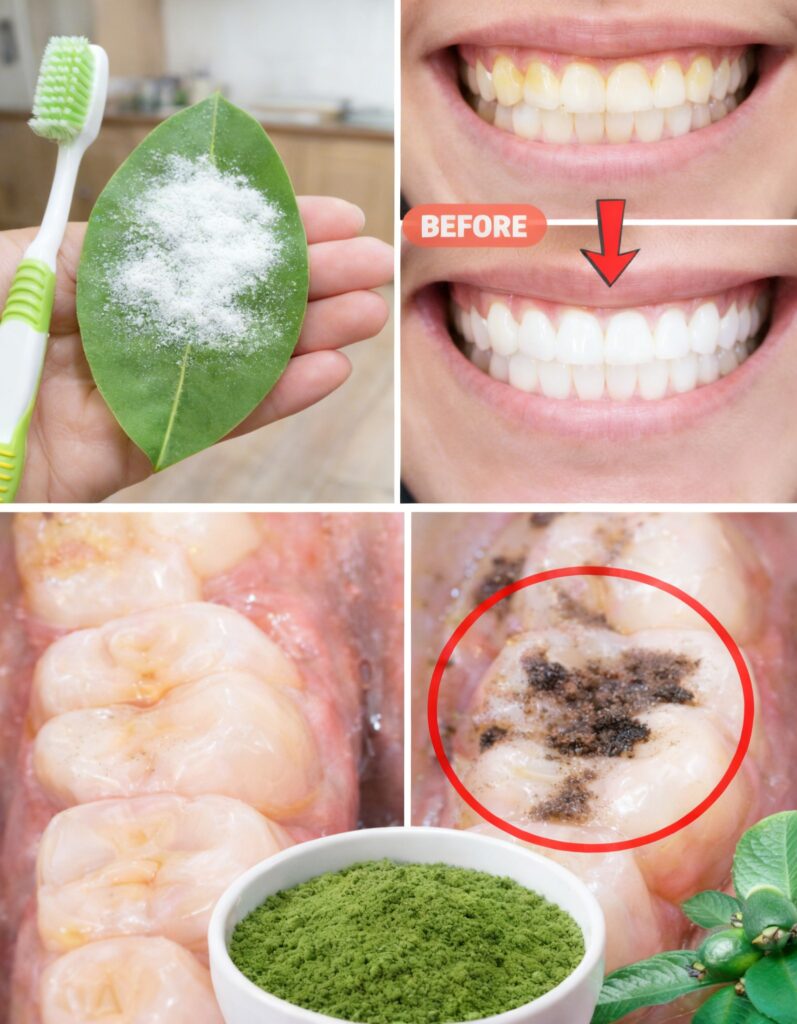 Guava Leaves for Oral Health A Traditional Daily Habit People With Cavities Find Surprisingly Helpful