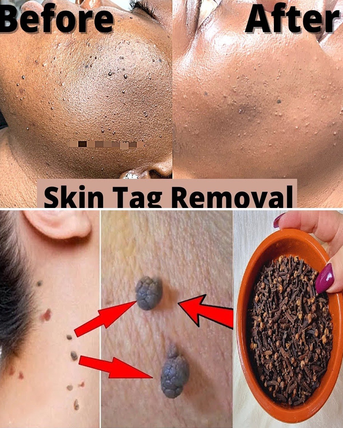 Unlock the Hidden Kitchen Secret That May Fade Dark Spots Overnight – A Natural Approach to Brighter Skin