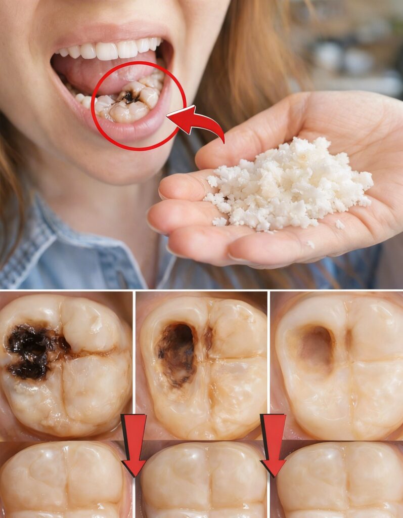 Keep These Tips in Mind to Avoid Visiting the Dentist: How to Naturally Support Early Cavity Repair