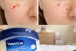 Those Stubborn Little White Bumps: Understanding Milia and Safe Ways to Improve Your Skin’s Appearance
