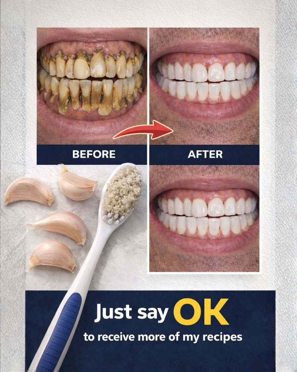 The Fastest Way to Brighten Your Smile at Home: A Simple 3-Minute Baking Soda and Hydrogen Peroxide Paste