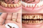 9 Natural Approaches to Help Reduce Plaque & Tartar Buildup – Gentle Home Strategies for a Brighter Smile