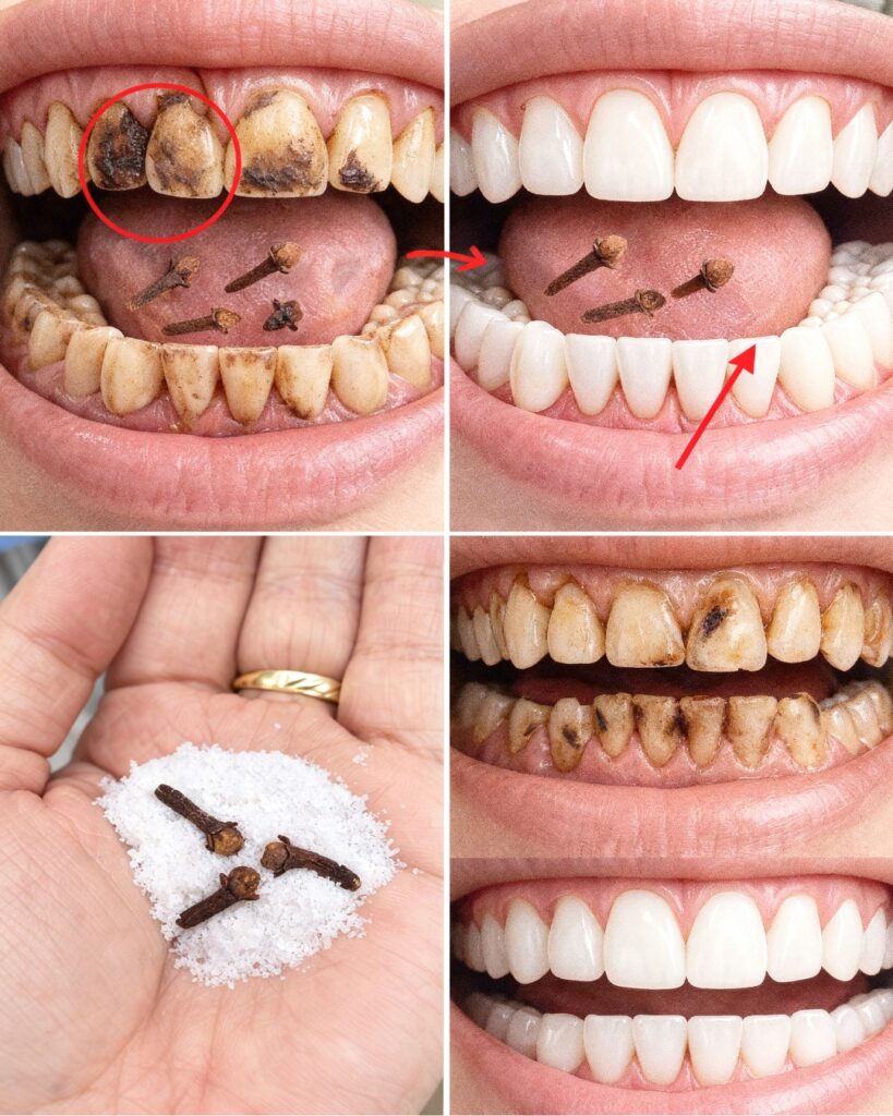 9 Natural Approaches to Help Reduce Plaque & Tartar Buildup – Gentle Home Strategies for a Brighter Smile