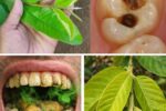 3 Genius Ways to Use Guava Leaves for Better Oral Care Habits and Healthier Teeth