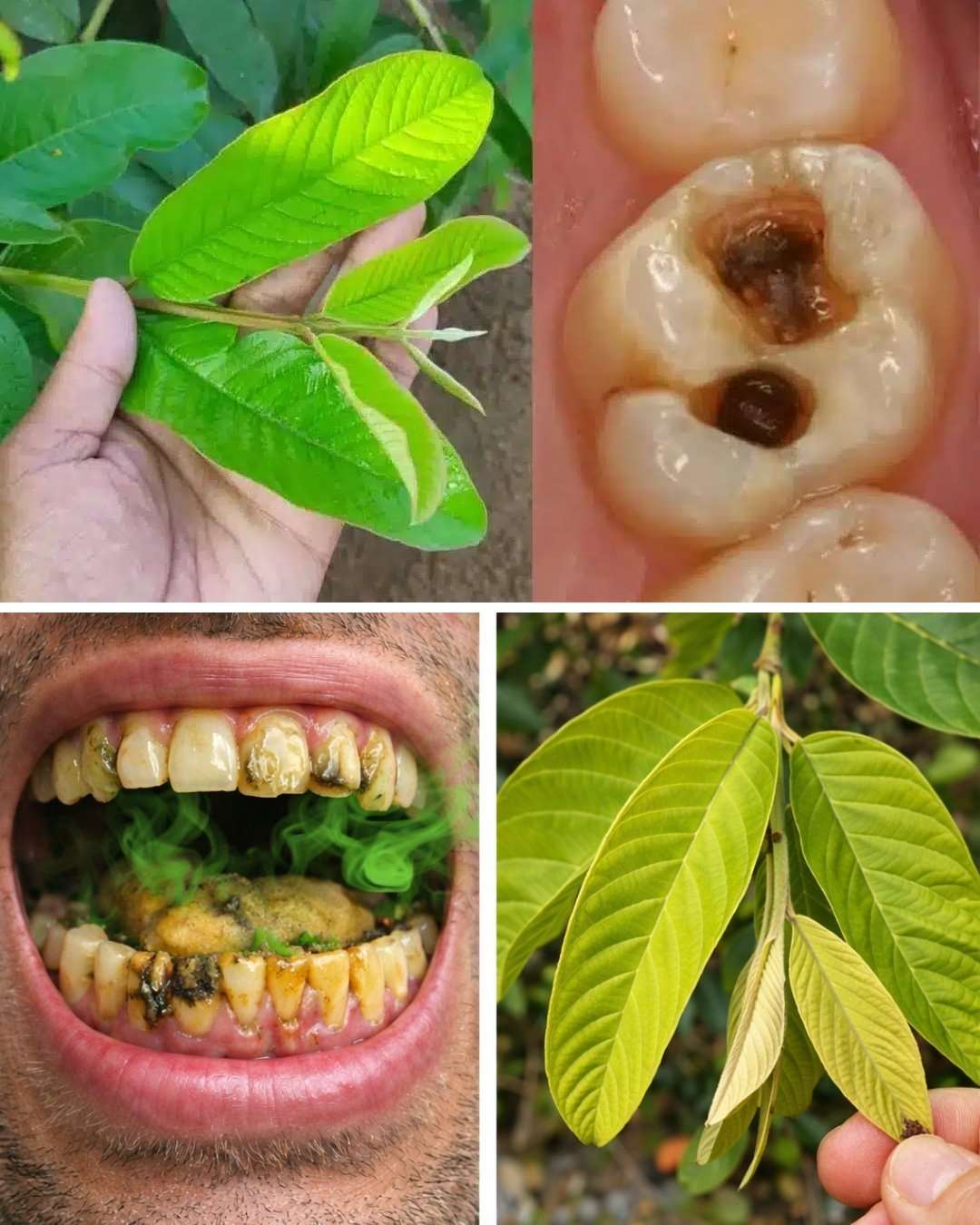 3 Genius Ways to Use Guava Leaves for Better Oral Care Habits and Healthier Teeth