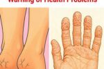 8 Imperceptible Changes in Your Body that Could Be Warning of Health Problems