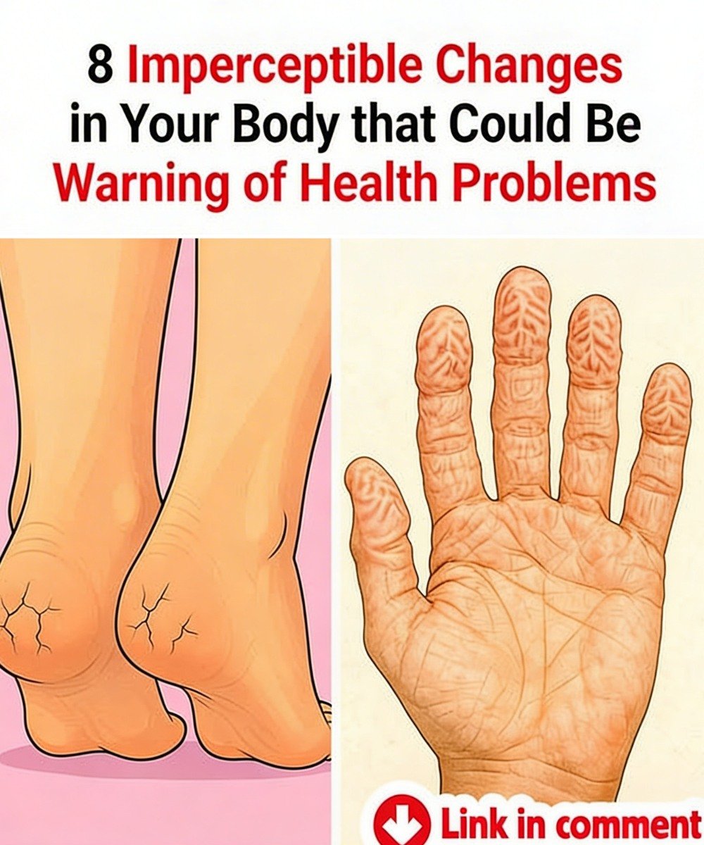 8 Imperceptible Changes in Your Body that Could Be Warning of Health Problems