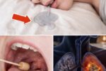 Drooling While Sleeping What It Could Mean and 8 Health Conditions to Know