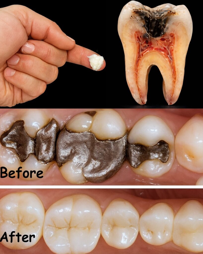 Simple Natural Tips to Keep Your Teeth Healthy: 5 Powerful Home Remedies That May Help Prevent Cavities and Reduce Dental Visits