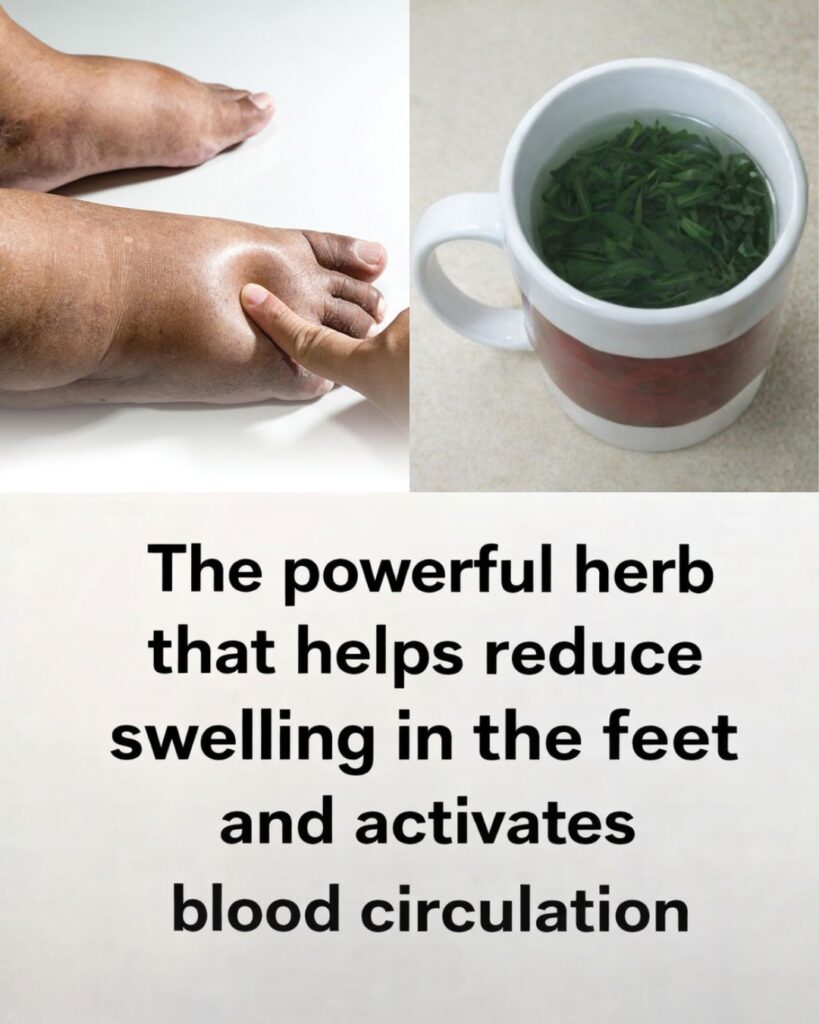 8 Best Diuretic Teas to Reduce Bloating and Fluid Retention Naturally