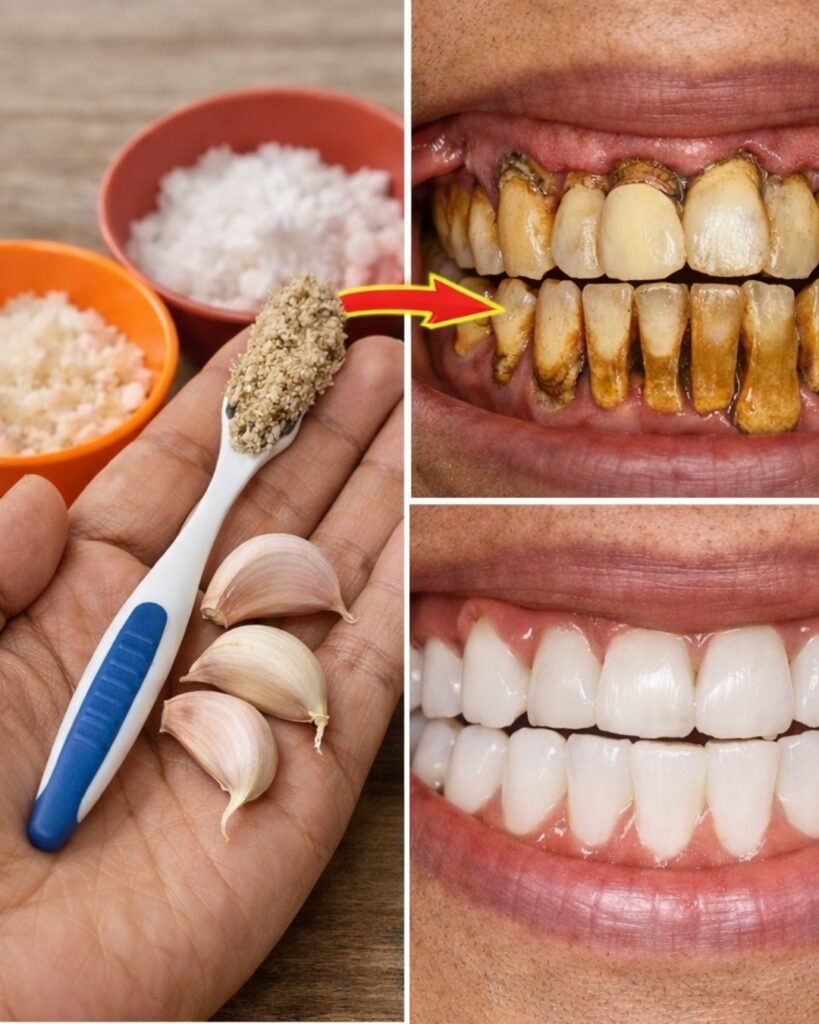 Discover a Simple Natural Way to Brighten Your Smile at Home