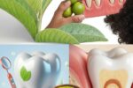 Top 3 Ways to Treat Tooth Decay with Guava Leaves – Simple and Cost-Effective