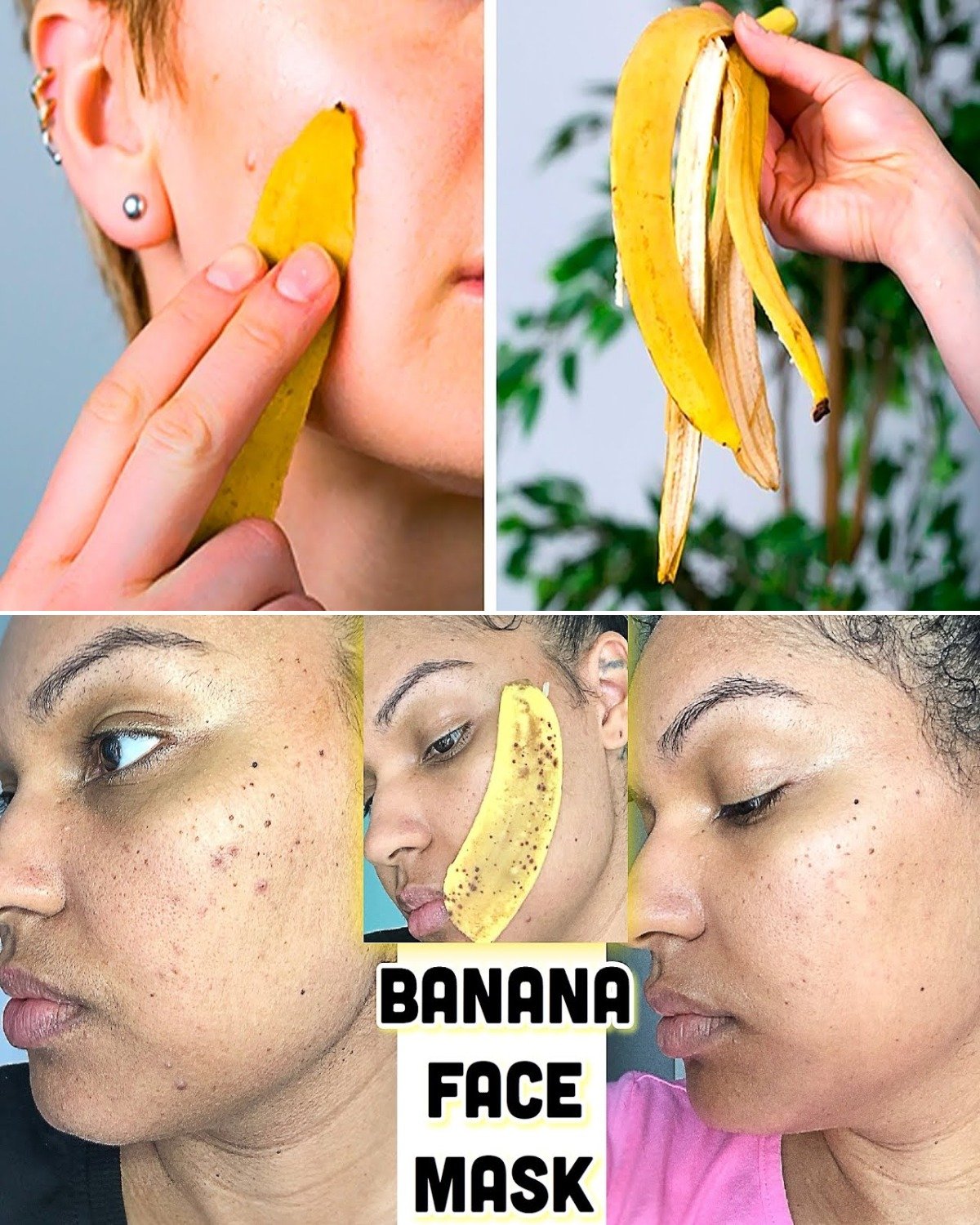 How to Take Care of Your Skin Naturally at Home with Banana Peels (The Glow-Up Secret Almost Everyone Throws Away)