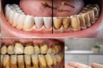 9 Natural Approaches to Help Reduce Plaque & Tartar Buildup – Gentle Home Strategies for a Brighter Smile