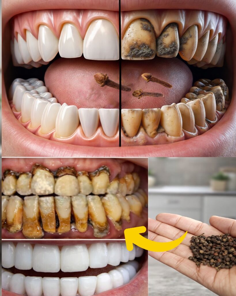 9 Natural Approaches to Help Reduce Plaque & Tartar Buildup – Gentle Home Strategies for a Brighter Smile