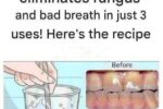 Whitening Teeth Naturally with Bay Leaves and Cloves A Dental Tip