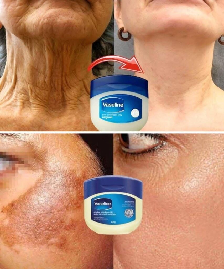 Vaseline and White Vinegar: Amazing Hacks You Never Knew