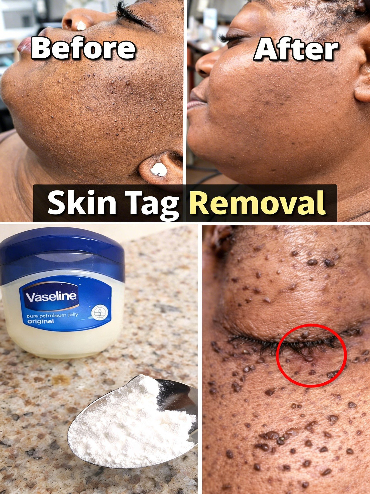 How to Explore Natural Home Approaches for Skin Tags Using Vaseline and Common Ingredients