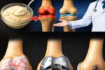 97 Year Old Orthopedic Doctor Reveals: JUST 1 Food Rebuilds KNEE Cartilage in 24 Hours