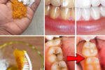 Turmeric for Teeth Whitening: Does This Natural Remedy Really Work?