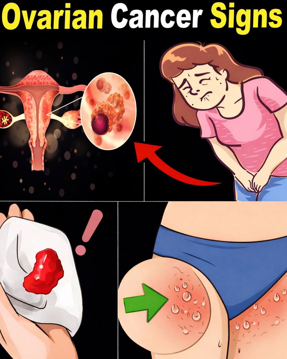 8 Signs of Ovarian Cancer Every Woman Should Watch For