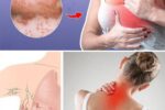 10 Warning Signs of Breast Cancer You Should Never Ignore