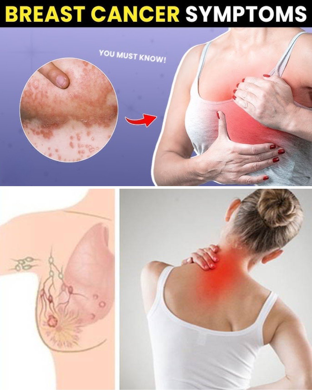 10 Warning Signs of Breast Cancer You Should Never Ignore