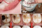 Simple Daily Oral Care Habits That Help You Avoid Extra Dental Visits Naturally