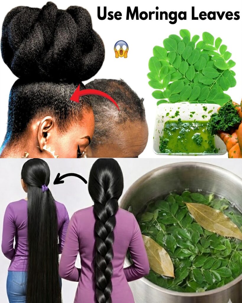 Moringa Leaves: The Natural Secret That Could Double Your Hair Growth (Science, Stories & Simple DIY Method)