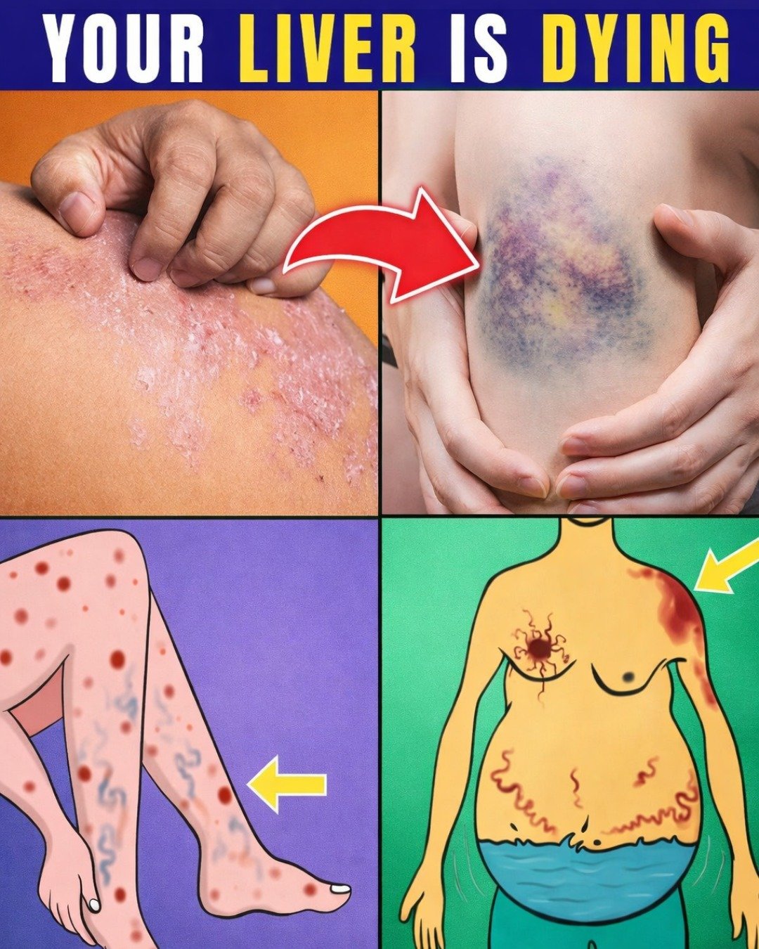 Warning: 12 Weird Signs That Show You’re Having Liver Damage