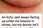 An itchy rash keeps flaring up under my breasts in winter, but my doctor isn’t available right now. What can I do today?