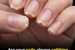 Weak or Brittle Nails: What Your Body Is Trying to Tell You