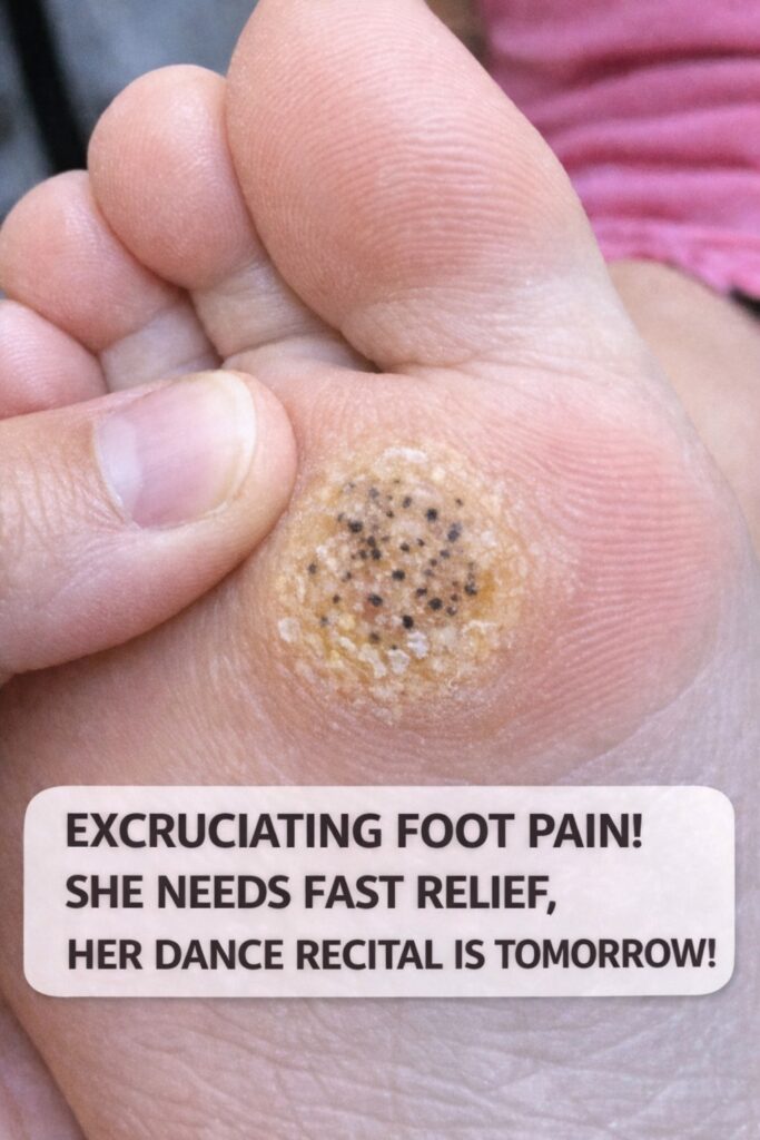 Painful Hard Spot With Black Dots on the Sole? It Could Be a Plantar Wart (Fast Relief Tips)