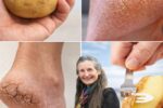 Potato Remedies: Using Potatoes for Cracked Heels and Skin Care – Simple, Natural Support for Softer Feet