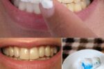 Brighten Your Smile Naturally: The Garlic and Baking Soda Mix That May Support Whiter Teeth in Minutes