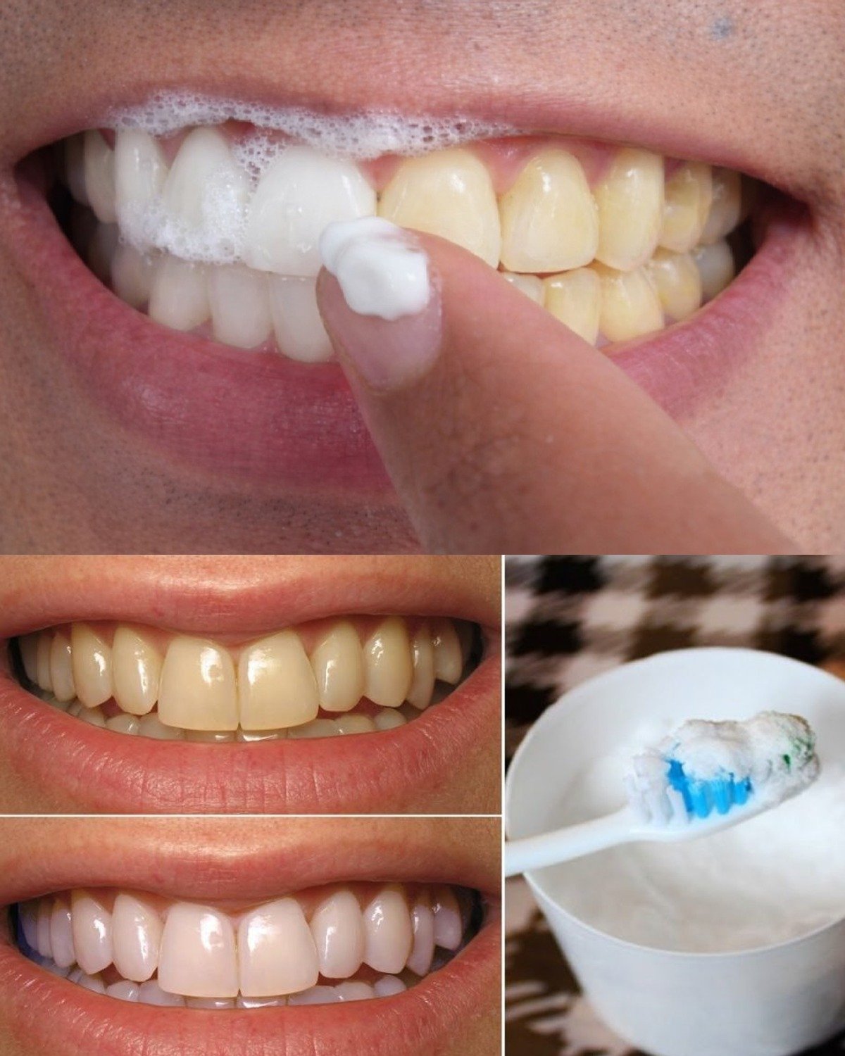 Brighten Your Smile Naturally: The Garlic and Baking Soda Mix That May Support Whiter Teeth in Minutes