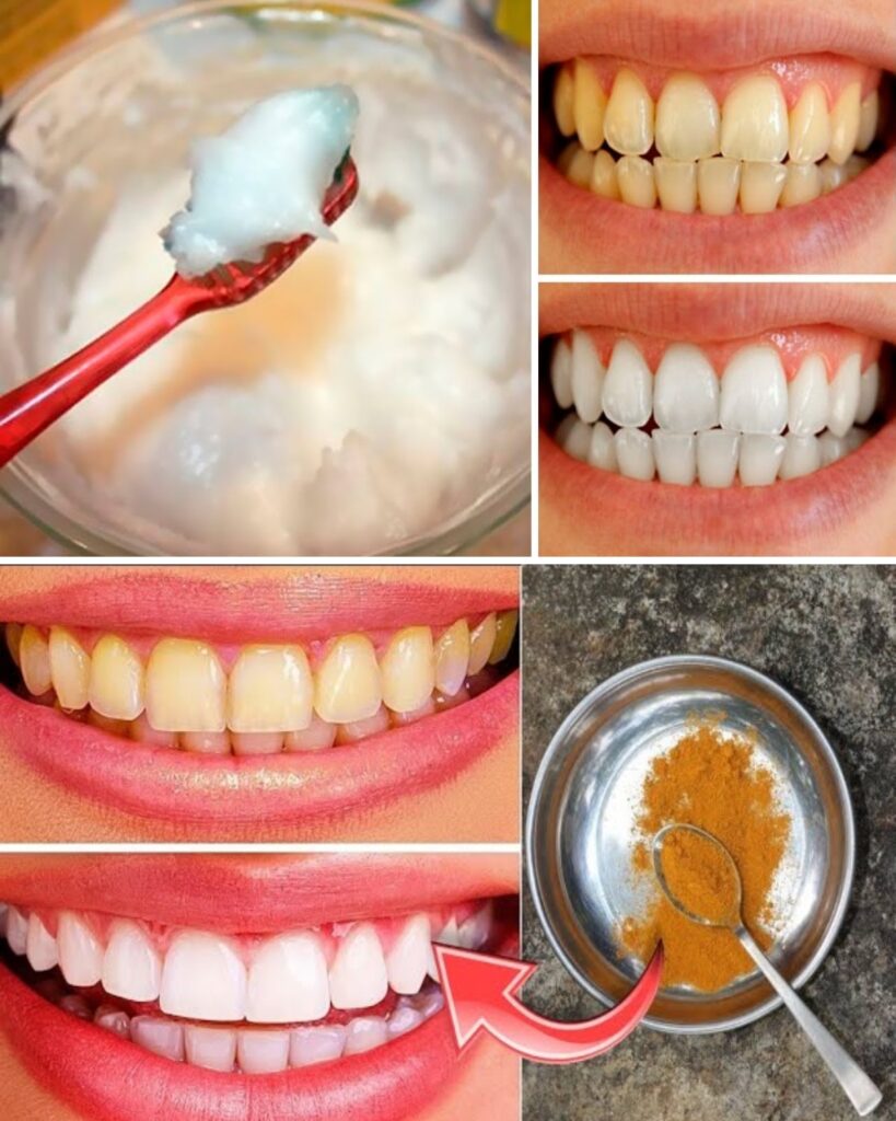 Brighten Your Smile Quickly: Simple Home Teeth Whitening Tricks in Minutes