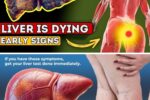 IS YOUR LIVER in DANGER? 12 Early Signs of LIVER CIRRHOSIS You Shouldn’t Ignore