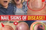 Nail Ridges: The Silent Health Warnings Your Nails Are Desperately Trying to Send You (And What They Really Mean)