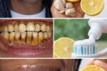 How to Naturally Whiten Yellow Teeth at Home: The Powerful Banana-Ginger-Lemon Secret Thousands Are Raving About