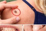 14 Warning Signs of Cancer You Should Never Ignore