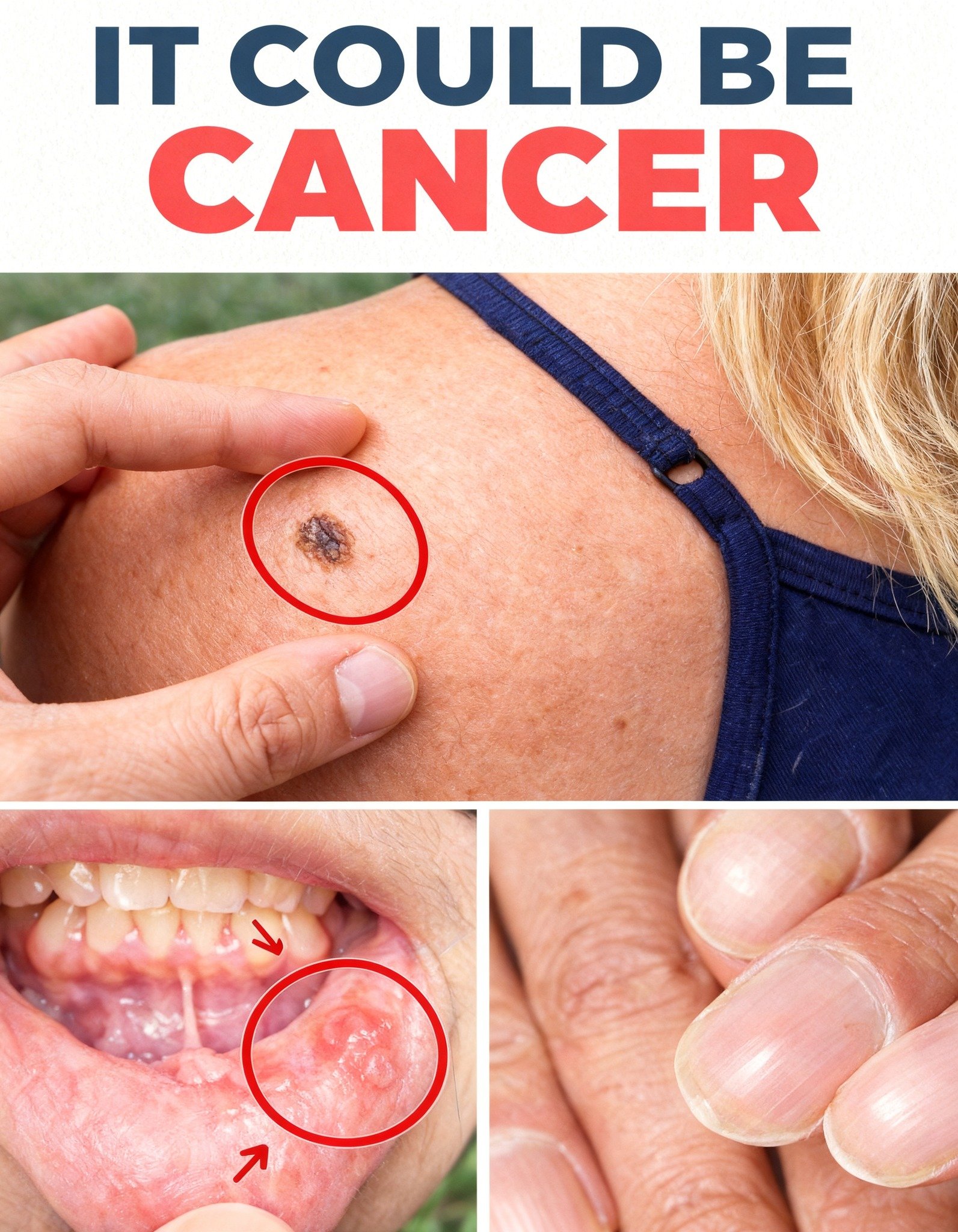 14 Warning Signs of Cancer You Should Never Ignore