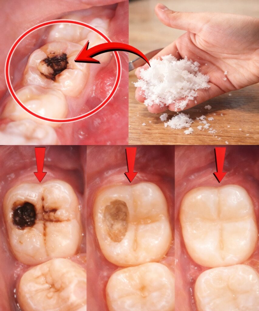 Avoid the Dentist’s Drill: Natural Tips to Support Early Cavity Repair